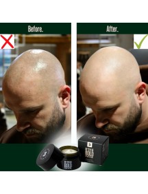 Better be bold Crème calvitie