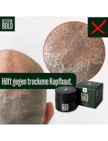 Better be bold Crème calvitie