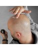 Glatzenpflege 0-3 mm